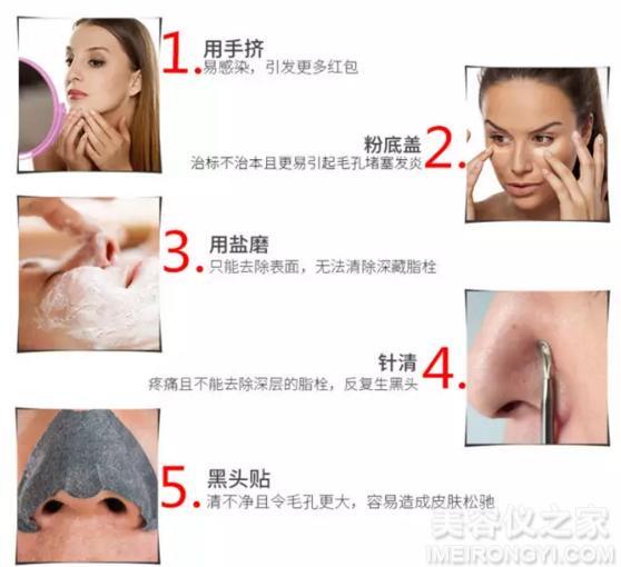 去黑頭的簡單小妙招，去黑頭小妙招分享，輕松告別黑頭困擾