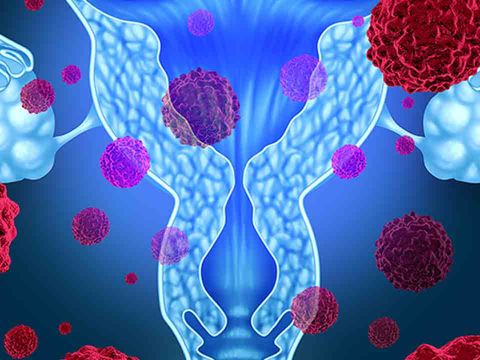 尖銳濕疣會自愈嗎？深入了解尖銳濕疣及其治療，尖銳濕疣能否自愈？全面解析尖銳濕疣及其治療方法