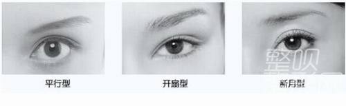 平扇與開扇雙眼皮，哪種更適合你？哪個更好看？，雙眼皮手術(shù)，平扇與開扇風(fēng)格的選擇與美觀度探討