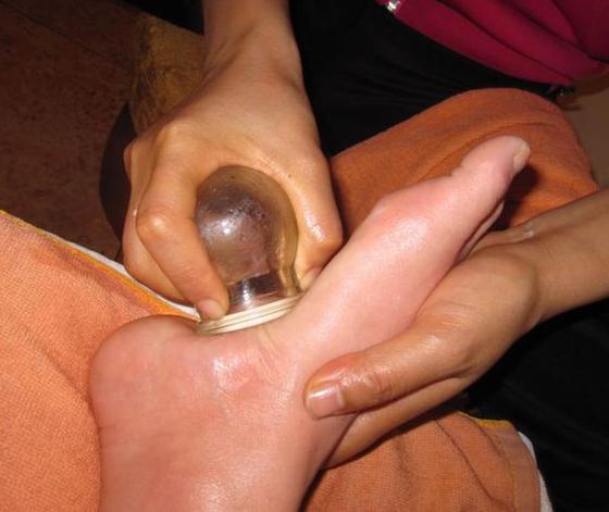 拔火罐對腎虛有好處嗎？深度解析傳統(tǒng)療法與現(xiàn)代健康理念，拔火罐對腎虛的益處解析，傳統(tǒng)療法與現(xiàn)代健康理念融合探索