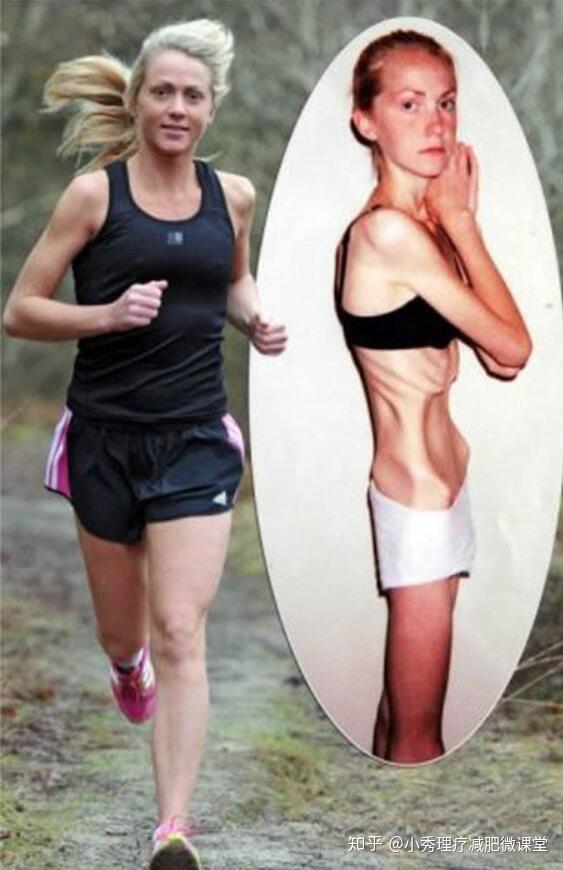 厭食癥的十大前兆，識別并預(yù)防的早期跡象，厭食癥的早期識別與預(yù)防，十大前兆詳解