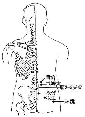 坐骨神經(jīng)痛的治療方法，哪種方式能最快緩解你的疼痛？，坐骨神經(jīng)痛快速緩解方法與治療方式探討
