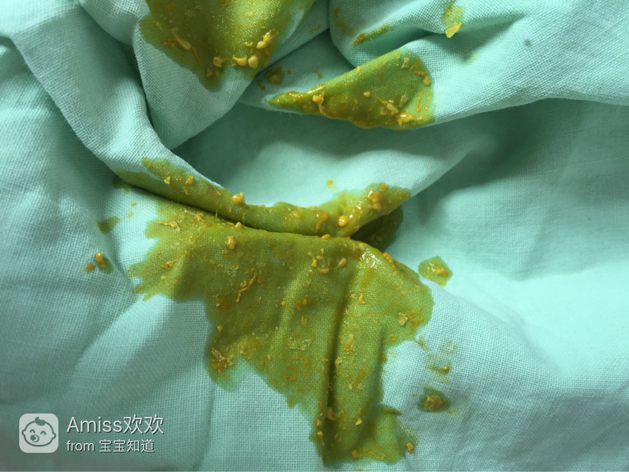 十來天的嬰兒老是拉稀怎么辦？全面解析寶寶腹瀉應對之策，嬰兒腹瀉應對指南，全面解析寶寶拉稀怎么辦？