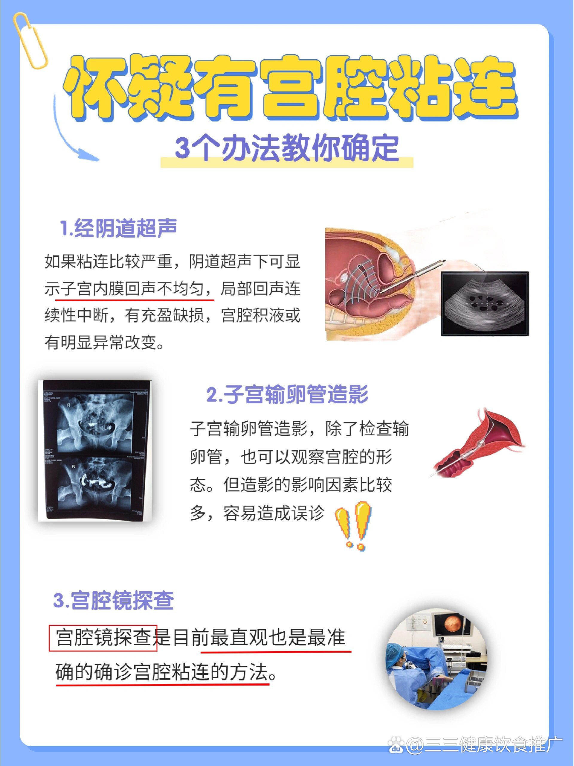 宮腔粘連自檢方法及其重要性，宮腔粘連自檢方法及其重要性解析