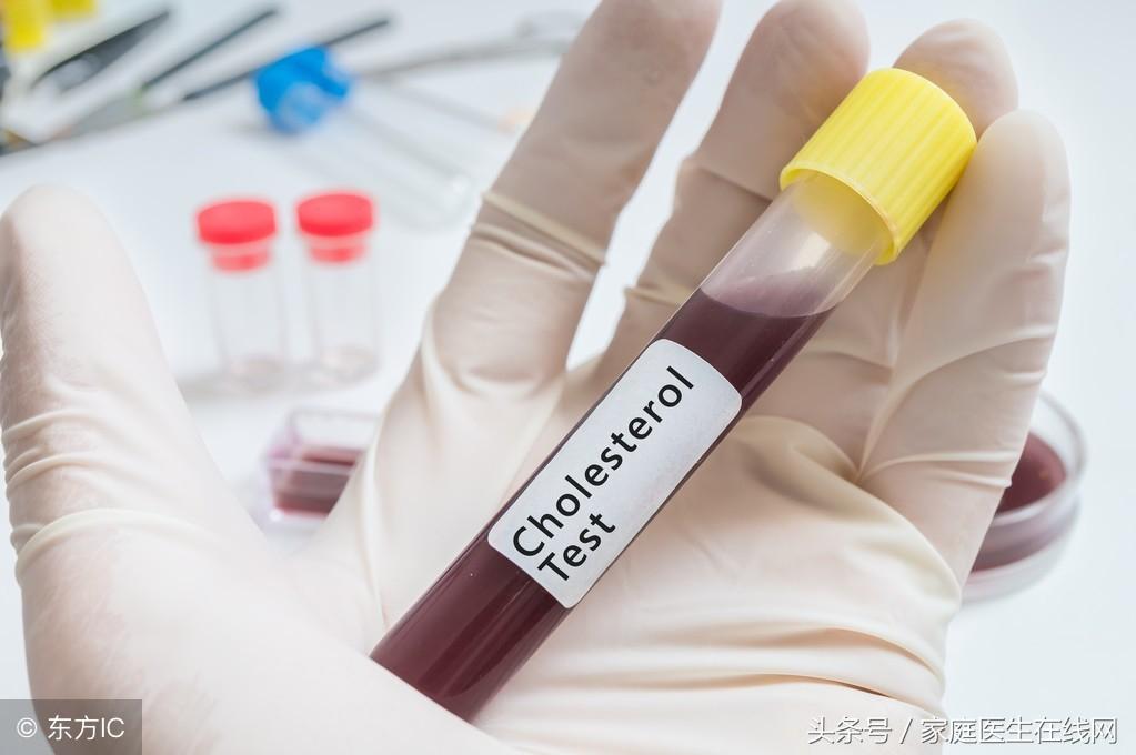 糖尿病的成因，深度解析其背后的原因，深度解析糖尿病成因，揭示背后原因真相