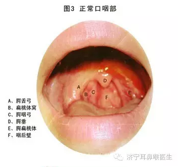 慢性咽炎三天斷根，真相還是幻想？，慢性咽炎三天斷根，真相還是幻想？揭秘治療真相。