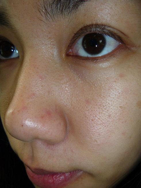 皮膚粗糙如何變得細(xì)膩，全面解析與實(shí)用建議，皮膚粗糙變細(xì)膩全面解析及實(shí)用建議攻略