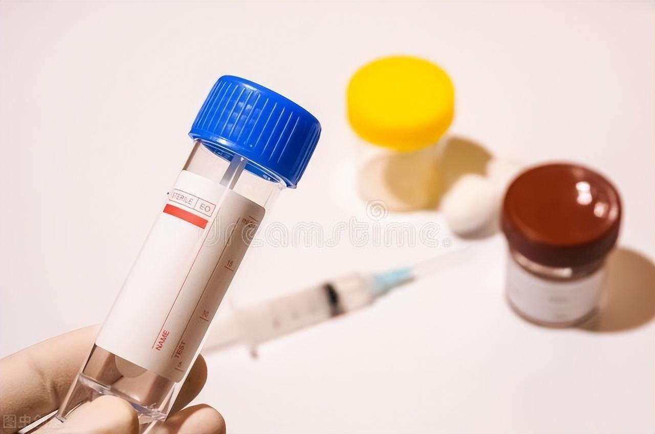 如何判斷是否得了痔瘡，痔瘡的判斷方法詳解