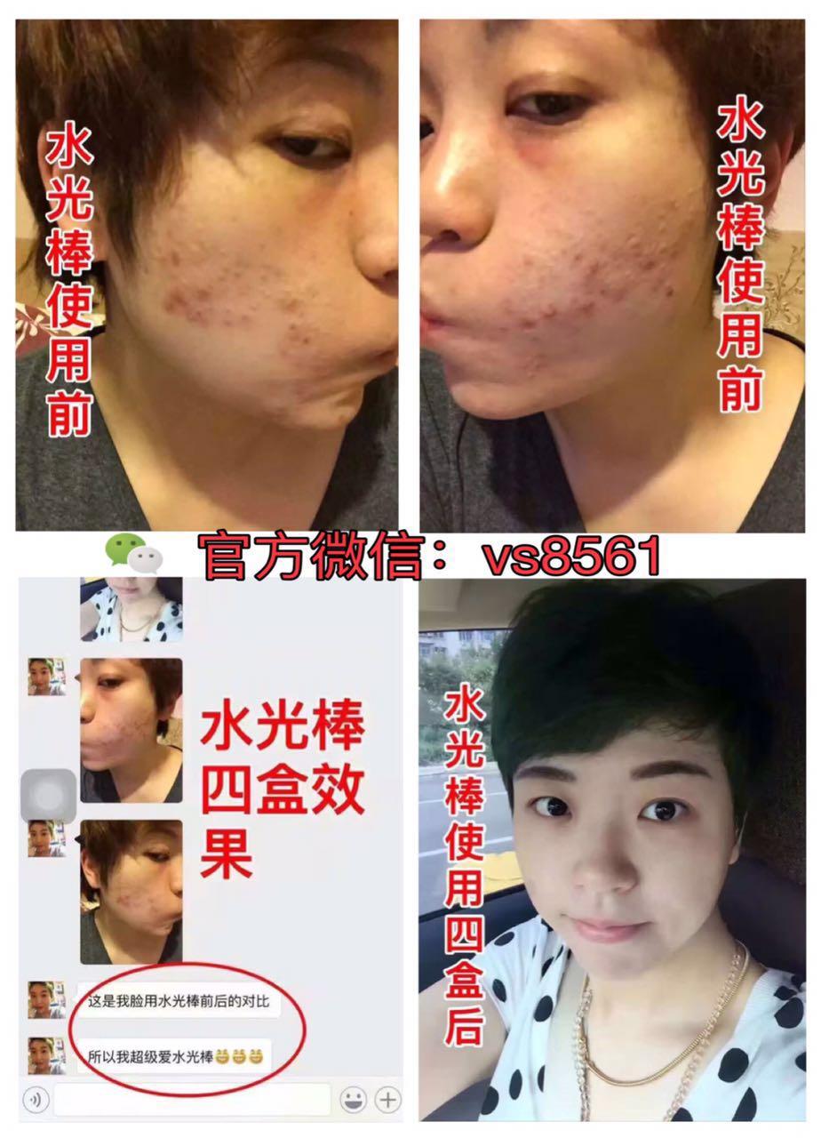 去除青春痘最有效的方法，全面解析最佳方案，全面解析，最有效的青春痘去除方案