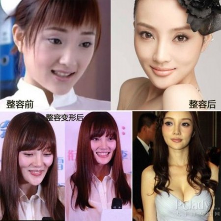 哪些女明星整容？深度解析背后的故事，深度解析女明星整容背后的故事