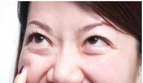 如何消除眼袋，方法與技巧詳解，消除眼袋的有效方法與技巧全解析