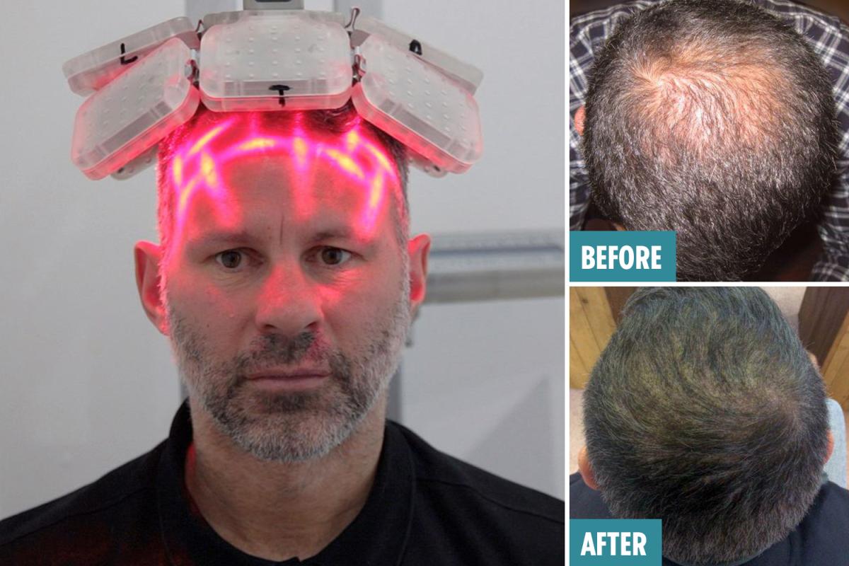 激光手術(shù)費用詳解，多少錢一次？，激光手術(shù)費用全面解析，手術(shù)費用究竟是多少？