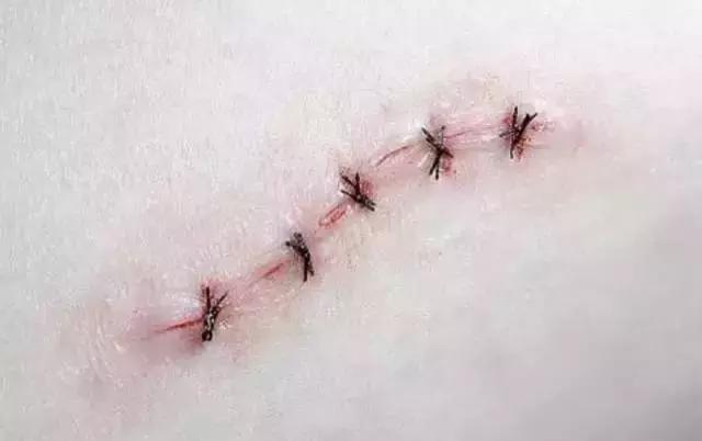 皮膚擦破皮了最快恢復(fù)方法不留疤——專業(yè)指南與實用建議，皮膚擦傷快速恢復(fù)不留疤，專業(yè)指南與實用建議