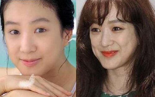 揭秘，韓國整容失敗的十大明星，揭秘，韓國整容失敗的明星TOP 10名單曝光