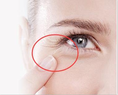 如何去除魚尾紋，最佳方法與實用建議，去除魚尾紋，最佳方法與實用建議攻略