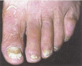 全面解析，100種皮膚病對照表圖片，100種皮膚病對照表圖片，全面解析皮膚病癥狀與類型