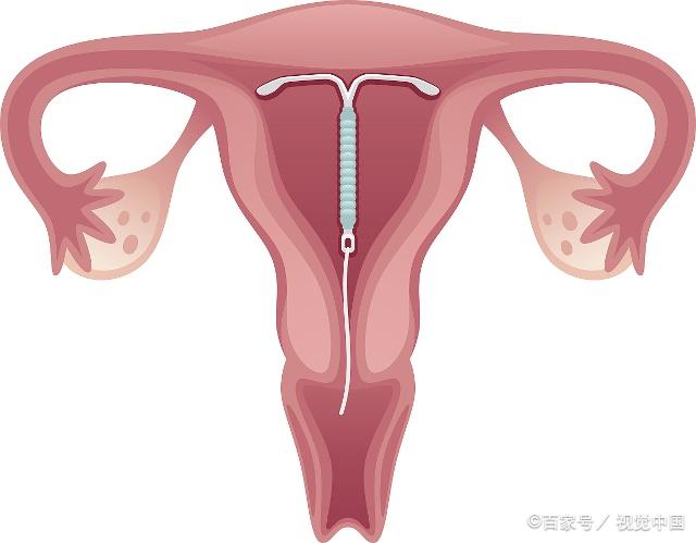 常見八種陰型照片及其特點解析，常見八種陰型照片特點深度解析