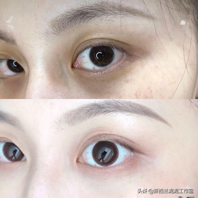 眼紋嚴(yán)重？快速有效的去眼紋方法大揭秘，揭秘快速有效的去眼紋方法，告別眼部皺紋煩惱！