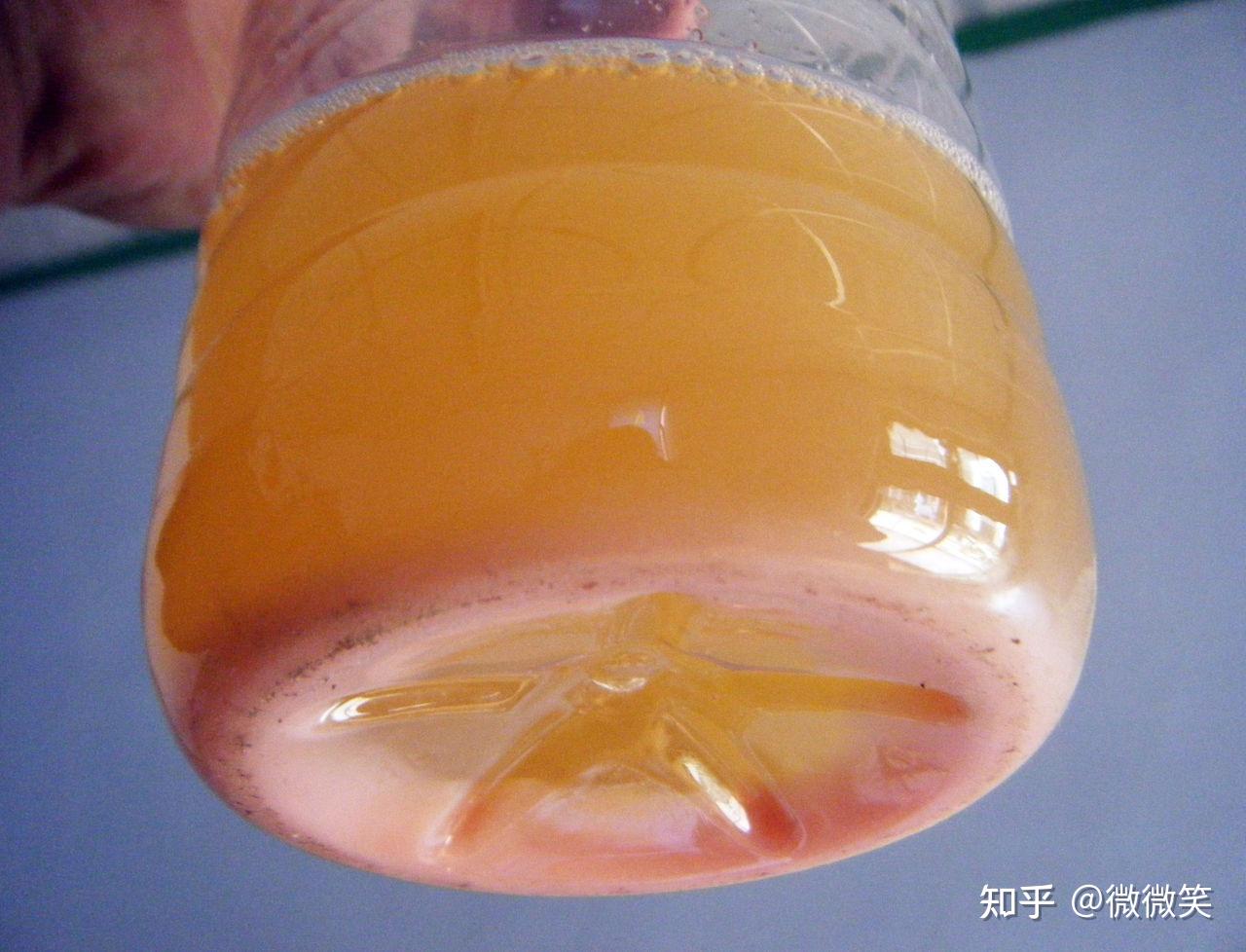 蛋白尿可以自愈嗎？解析真相與關(guān)鍵注意事項(xiàng)，蛋白尿能否自愈？解析真相及注意事項(xiàng)