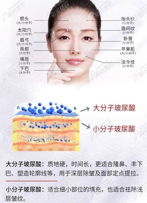 玻尿酸的作用與功效，深入了解玻尿酸的奧秘，玻尿酸的作用與功效揭秘，深入了解玻尿酸的神奇之處