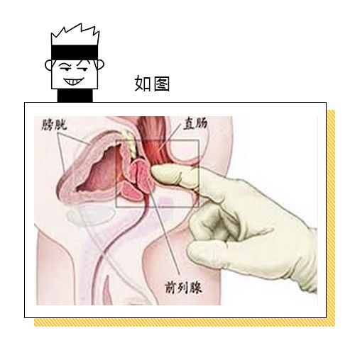 前列腺按摩手法與位置指南，全面解析與實踐，前列腺按摩手法與位置指南，全面解析與實踐技巧
