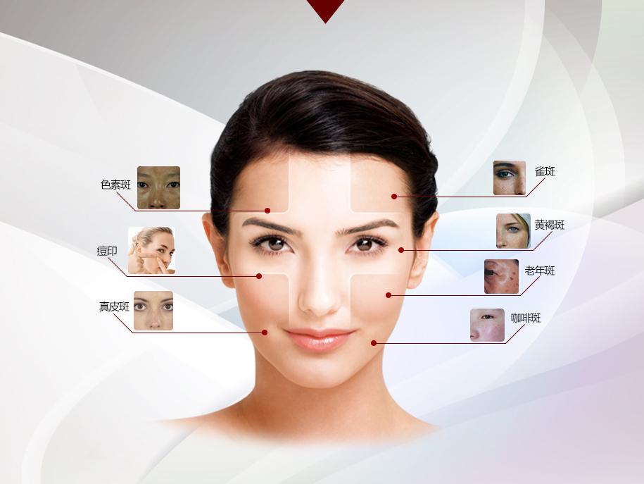 激光祛斑，一次能否徹底去除斑點？，激光祛斑能否一次徹底去除斑點？