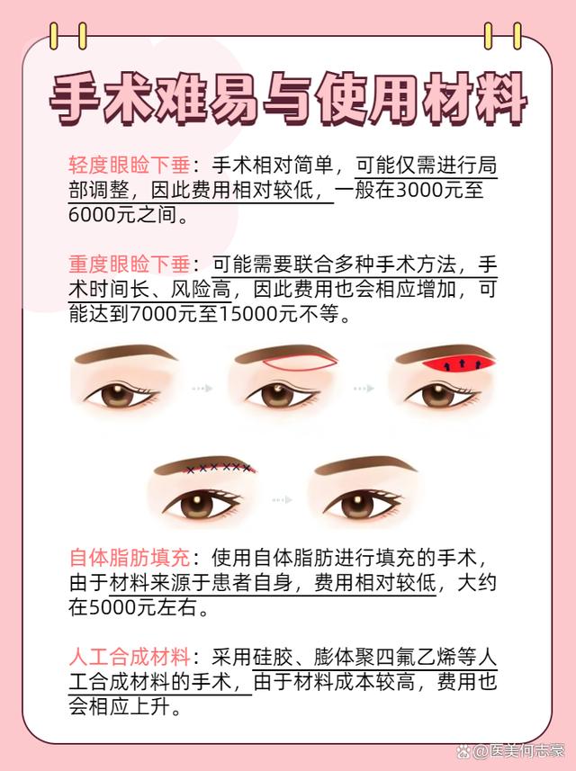 眼瞼下垂手術(shù)費用詳解，大約多少錢？，眼瞼下垂手術(shù)費用解析，手術(shù)費用究竟是多少？
