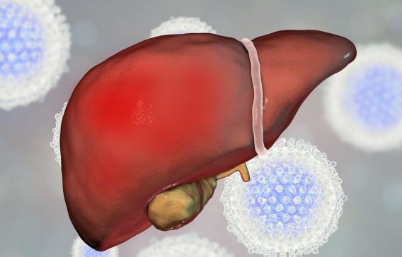 肝硬化的癥狀及表現(xiàn)，肝硬化的癥狀與表現(xiàn)概述