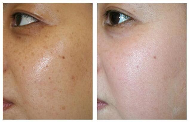 膚色暗沉發(fā)黃怎么調(diào)理，全方位美白亮膚攻略，全方位美白亮膚攻略，調(diào)理膚色暗沉與發(fā)黃問題