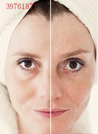 曬斑如何淡化或去掉——美白肌膚的秘訣，曬斑淡化與去除方法，美白肌膚的秘訣