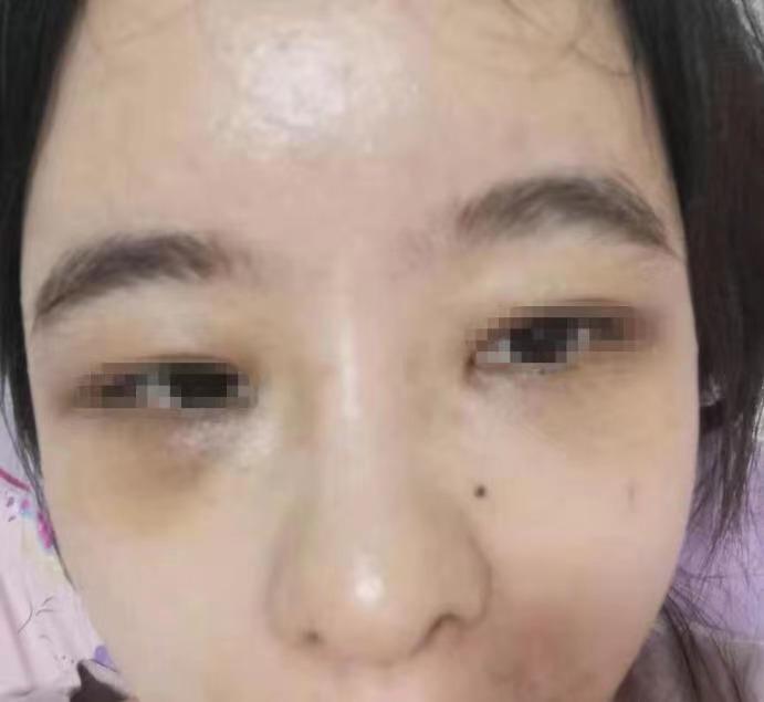 鼻整形，探索最佳實(shí)踐，實(shí)現(xiàn)美麗與自信的完美融合，鼻整形，最佳實(shí)踐探索，美麗與自信的和諧融合