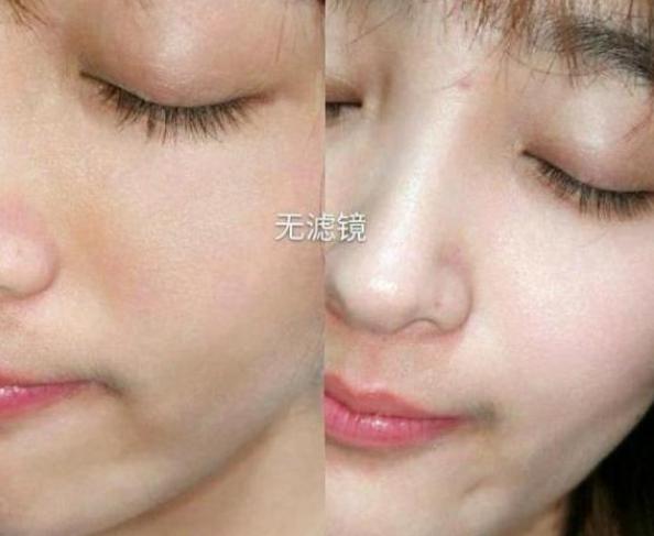 探索美白秘訣，五種讓臉部肌膚快速變白的方法，五種方法助你快速美白臉部肌膚，探索美白秘訣！