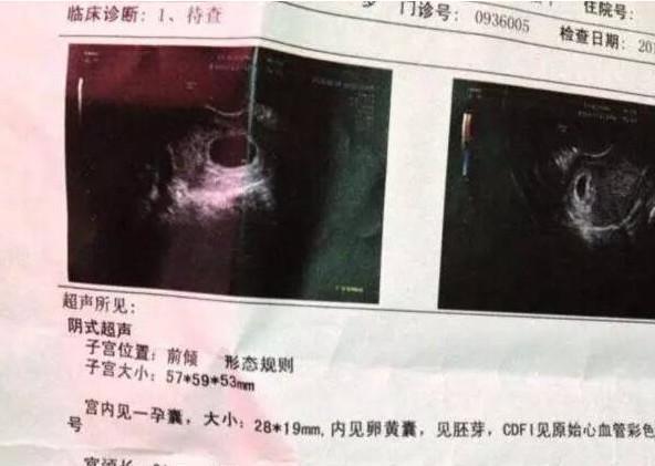 懷孕三個月自測男女，了解胎兒性別預(yù)測方法及注意事項，懷孕三個月胎兒性別預(yù)測方法及注意事項，自測男女須知