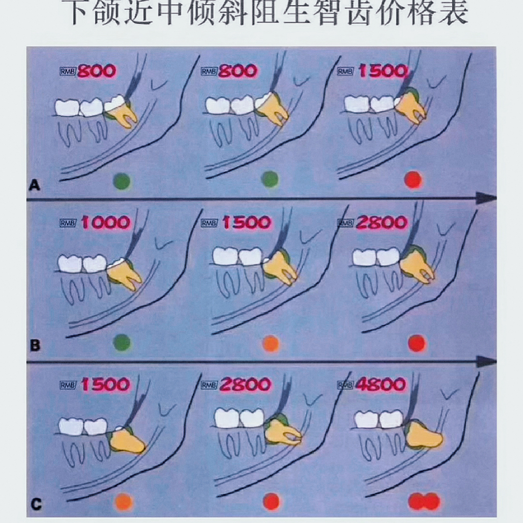 拔智齒收費標準的全面解析，拔智齒收費標準的深度解析與探討