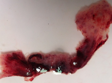 關于孕囊掉落的圖片，懷孕初期的生理變化與經(jīng)驗分享，孕囊掉落圖片及懷孕初期生理變化與經(jīng)驗分享