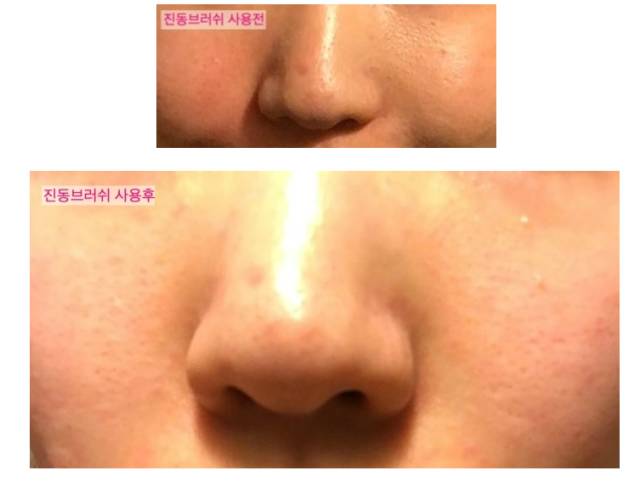 激光美白，讓你膚色煥新，白幾個(gè)度不再是夢(mèng)，激光美白，重塑膚色，白皙煥新不再是夢(mèng)