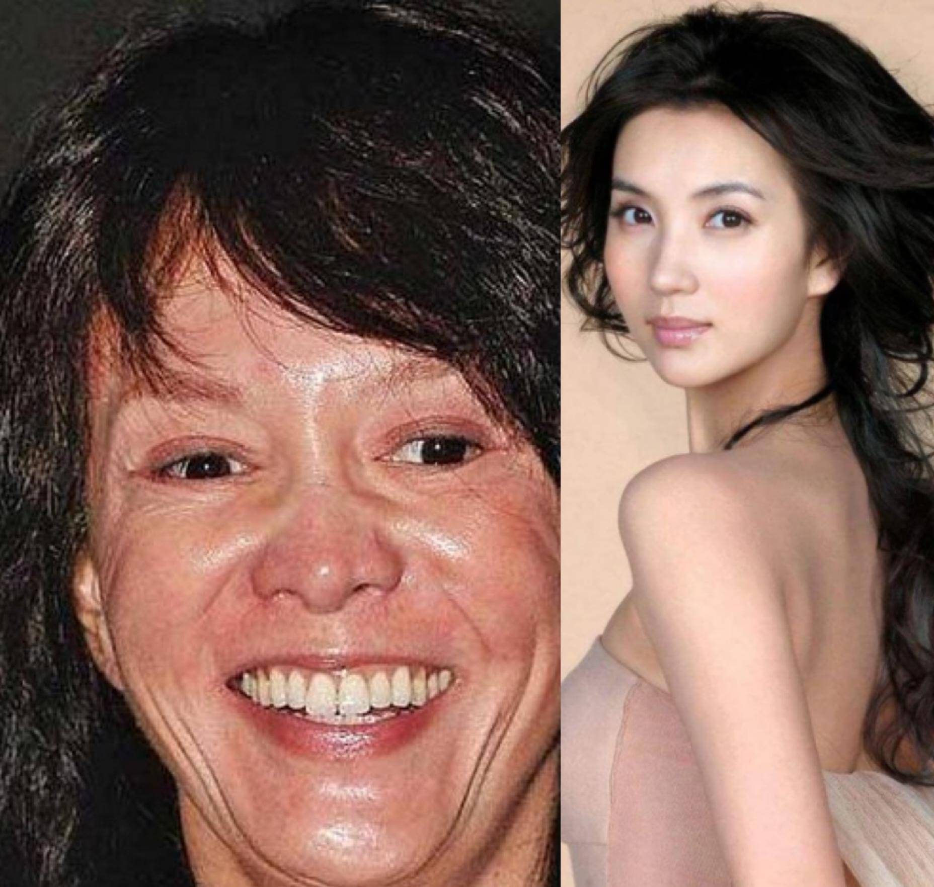 最早整容的明星，揭秘娛樂圈的先驅(qū)者們，揭秘娛樂圈先驅(qū)明星的整容歷程