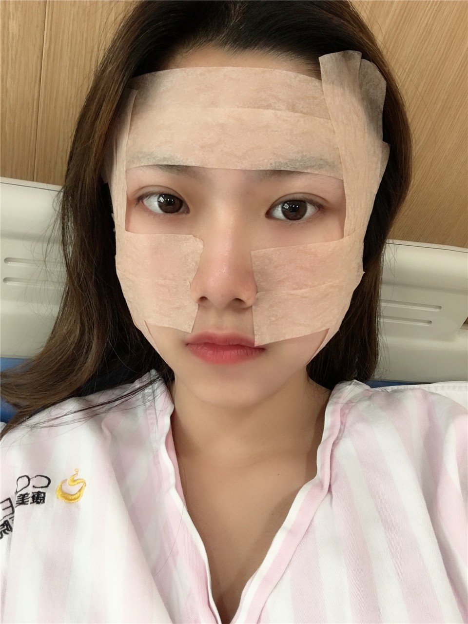 面部吸脂手術(shù)，重塑美麗輪廓的先進(jìn)選擇，面部吸脂手術(shù)，重塑輪廓的先進(jìn)之選