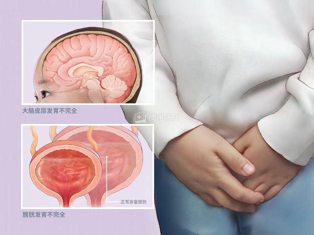 龜頭炎的癥狀表現(xiàn)及其影響，龜頭炎的癥狀表現(xiàn)及其影響分析