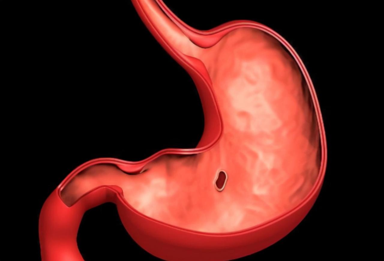 做胃鏡對胃傷害有多大，深入了解與關注，胃鏡對胃的影響，深入了解與關注