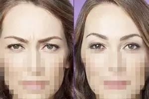 額頭千萬不能打除皺針，了解風(fēng)險與后果，做出明智選擇，額頭除皺針的風(fēng)險與后果，明智選擇需了解的內(nèi)容