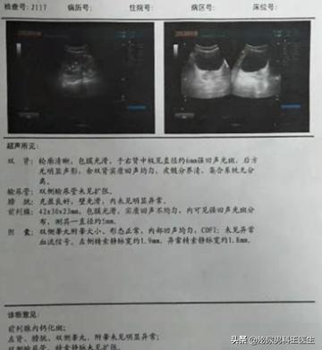 關(guān)于年輕男性前列腺鈣化，了解、應(yīng)對(duì)與關(guān)愛(ài)，年輕男性前列腺鈣化，認(rèn)知、應(yīng)對(duì)與關(guān)愛(ài)之道