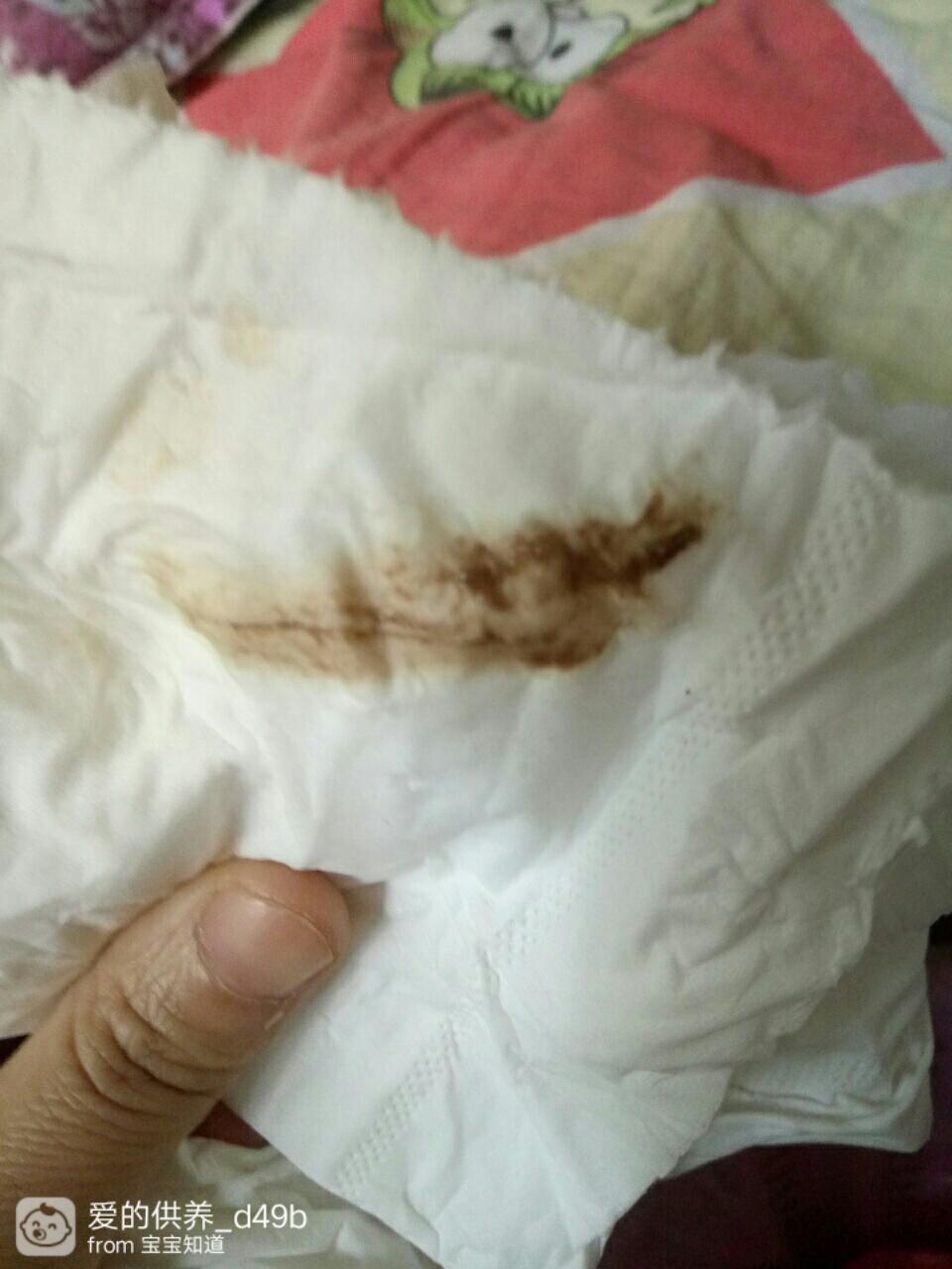 懷孕后流褐色血是好事嗎？——深入了解孕期出血真相，孕期流褐色血是好事嗎？揭秘孕期出血真相