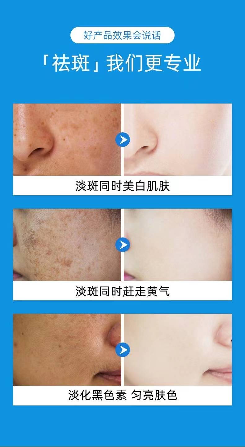 揭秘祛斑最佳方法，如何達(dá)到最佳祛斑效果？，揭秘最佳祛斑方法，實(shí)現(xiàn)最佳效果的秘訣！