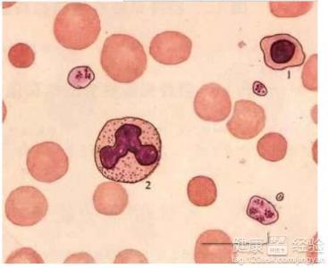 地中海貧血能生小孩嗎，全面理解與生育決策，地中海貧血患者的生育決策，全面理解與探討