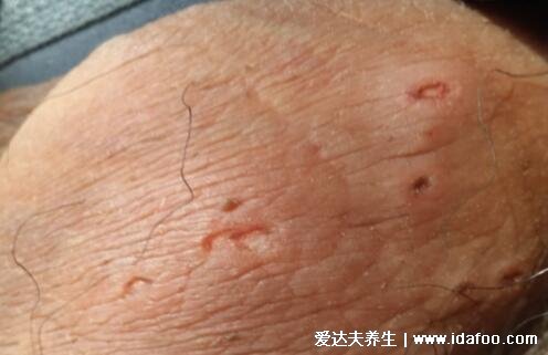 得性疾病前兆，了解、預(yù)防與應(yīng)對(duì)，得性疾病的早期信號(hào)，了解、預(yù)防與應(yīng)對(duì)策略