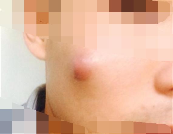 臉上一摸全是小顆粒，原因解析與應對方法，臉部小顆粒密布，原因解析及應對方法