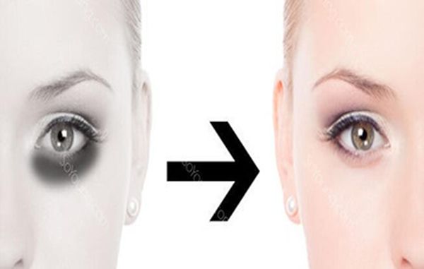 怎樣去黑眼圈最有效最快？全面解析黑眼圈消除方法，全面解析，快速有效消除黑眼圈的方法與技巧
