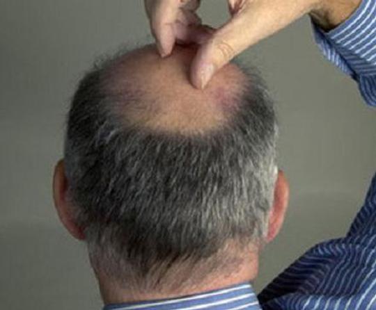 男人氣血不足腎虛的調(diào)理方法與日常保健，男人氣血不足腎虛調(diào)理方法與日常保健指南