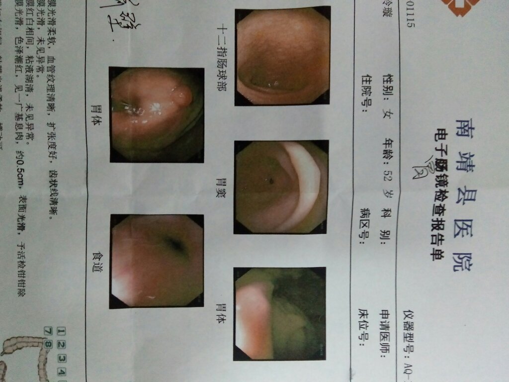 如何判斷自己是否患有胃炎——癥狀、檢查與預(yù)防，如何判斷自己是否患有胃炎，癥狀、檢查、預(yù)防全解析